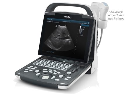 NUOVO ECOGRAFO MINDRAY DP-20