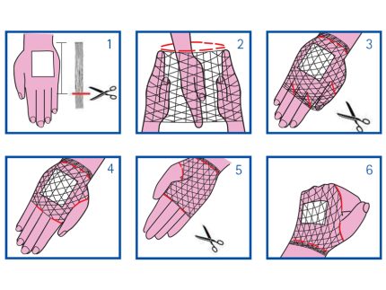 RETE TUBOLARE ELASTICA - calibro 2 per polso e mano