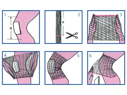 RETE TUBOLARE ELASTICA - calibro 5 per ginocchio e gamba